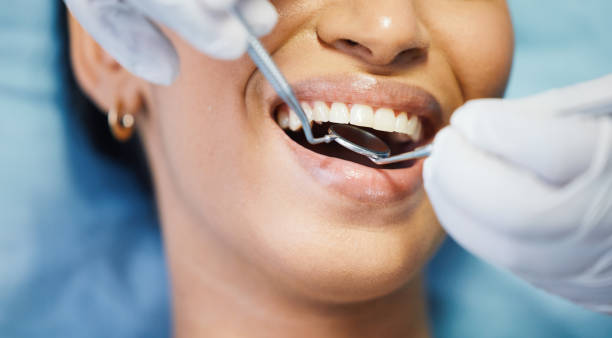 Best Cosmetic Emergency Dentistry in Summit, NJ